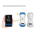 New Probe Cheap Sonoscape Portable Ultrasound Scanner for Sale